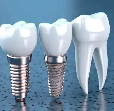 Implants